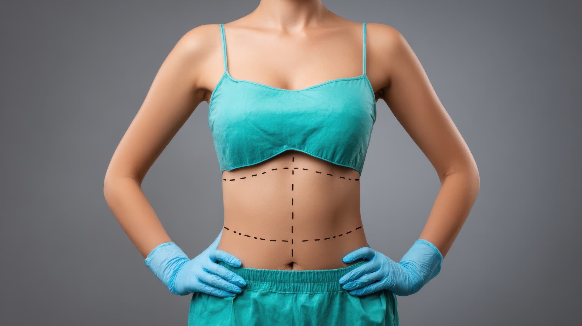 Chirurgie de la Silhouette
