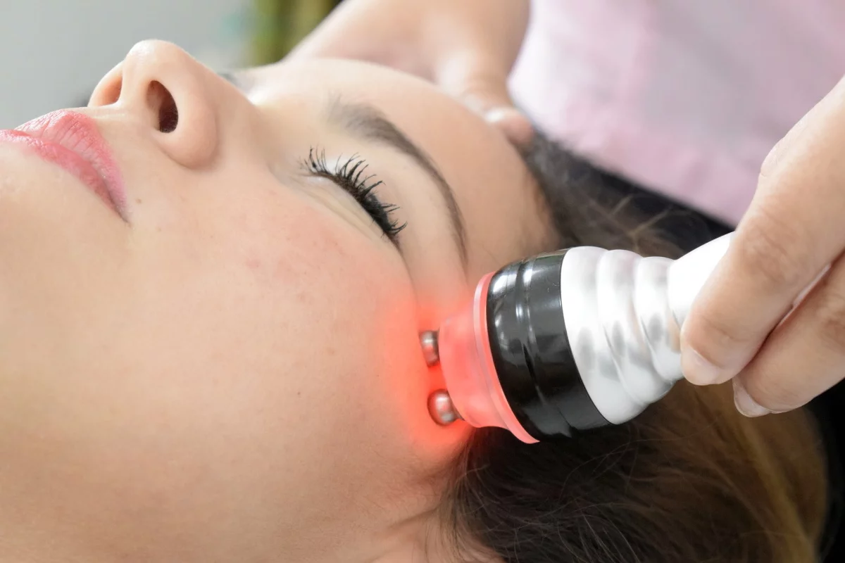 Radiofréquence & microneedling