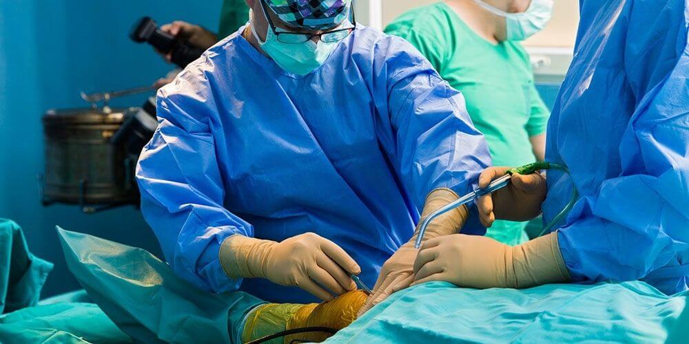 Chirurgie Orthopédique Esthétique