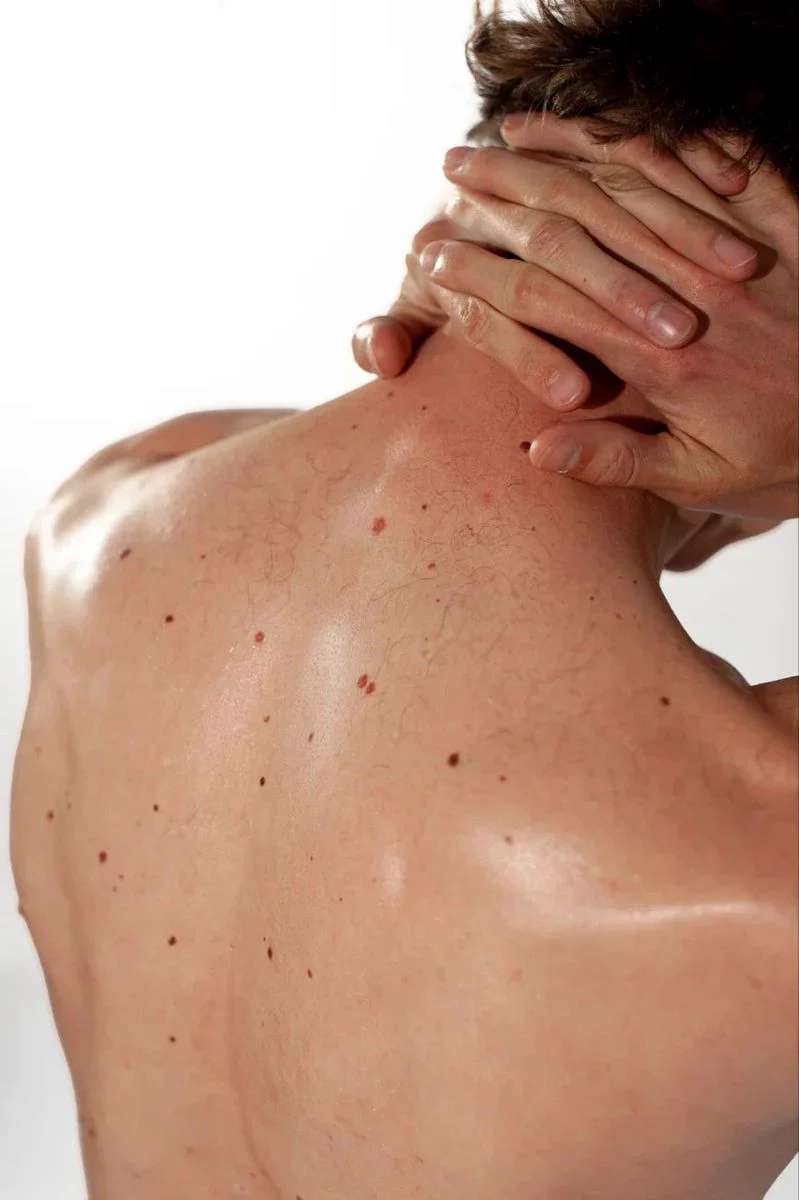 Lipofilling Pénien