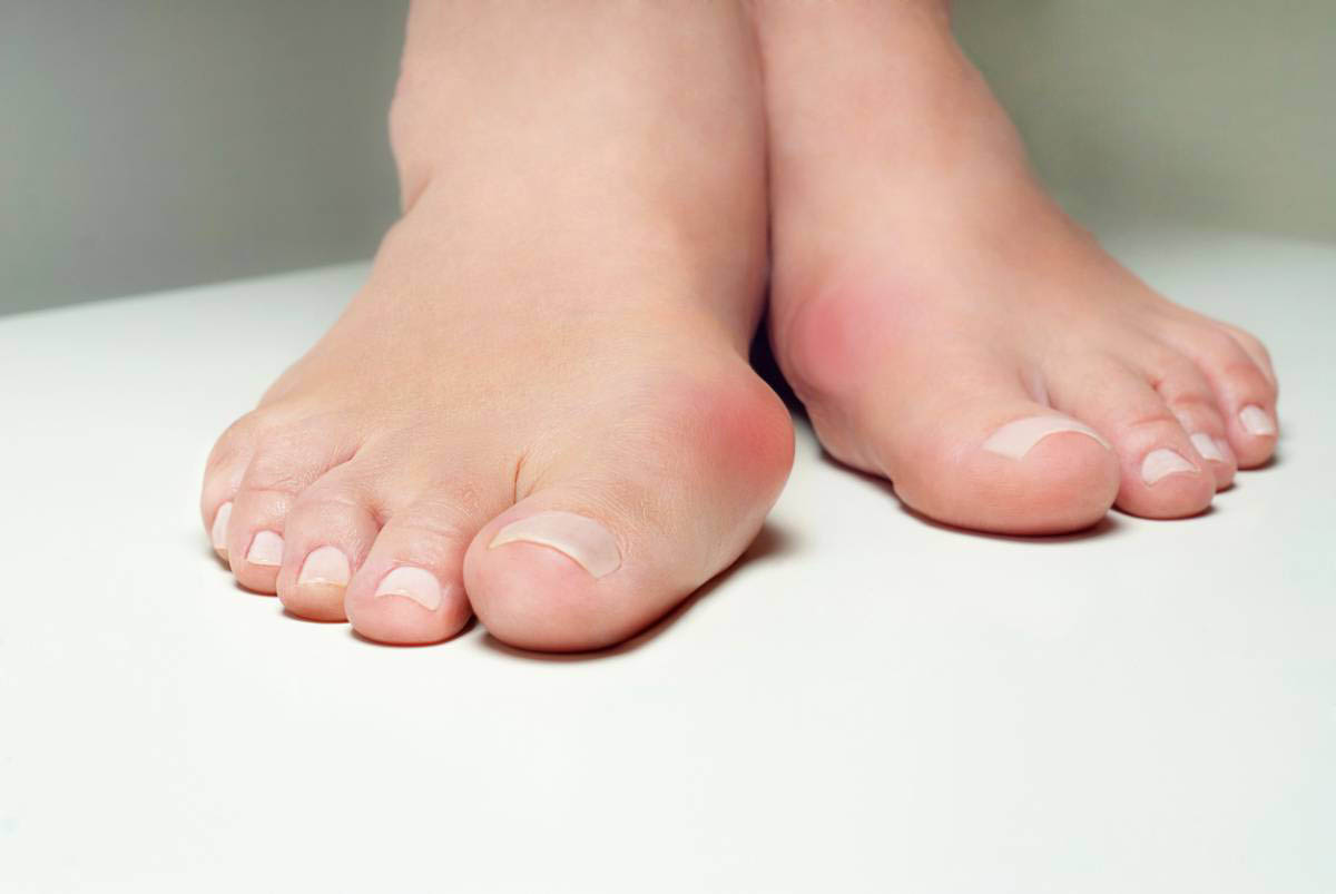 Chirurgie Esthétique des Orteils et des Pieds